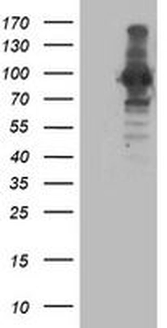 ANAPC2 Antibody in Western Blot (WB)