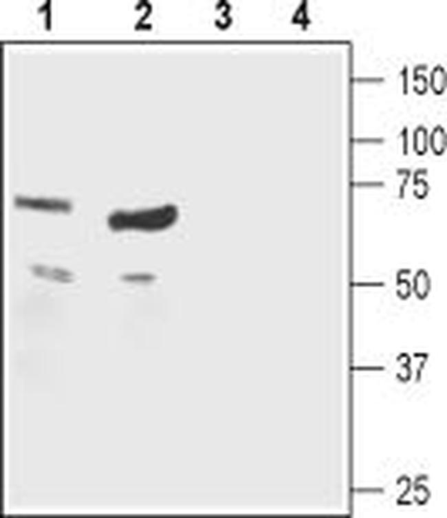 Nicotinic Acetylcholine Receptor beta 1 (CHRNB1) (extracellular) Antibody in Western Blot (WB)