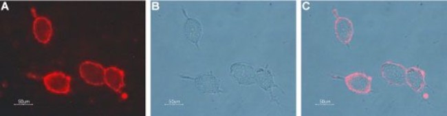 Nicotinic Acetylcholine Receptor beta 2 (CHRNB2) (extracellular) Antibody in Immunocytochemistry (ICC/IF)