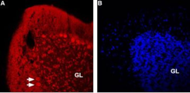 Nicotinic Acetylcholine Receptor beta 2 (CHRNB2) (extracellular) Antibody in Immunohistochemistry (IHC)