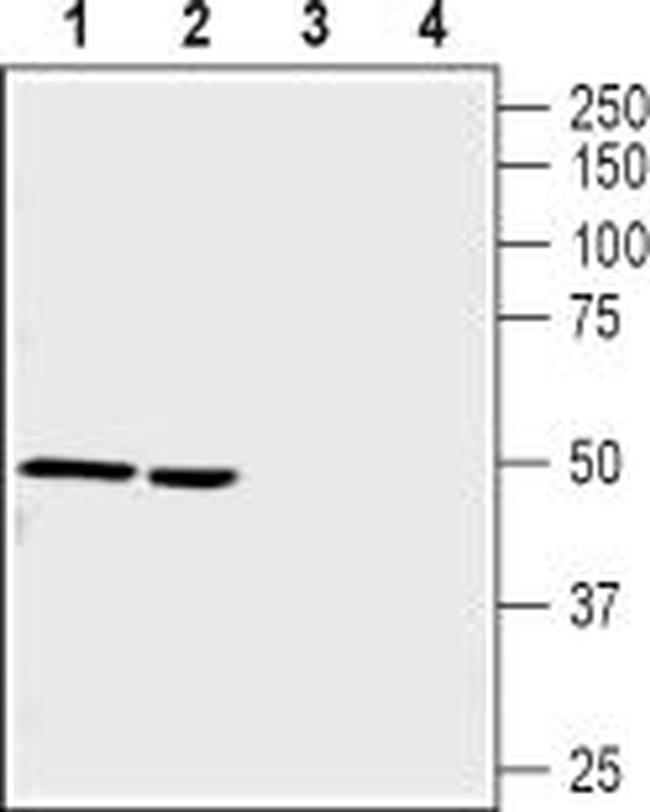 Nicotinic Acetylcholine Receptor alpha 9 (CHRNA9) Antibody in Western Blot (WB)