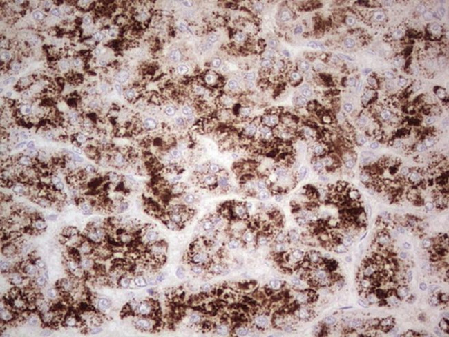 ANGPT1 Antibody in Immunohistochemistry (Paraffin) (IHC (P))