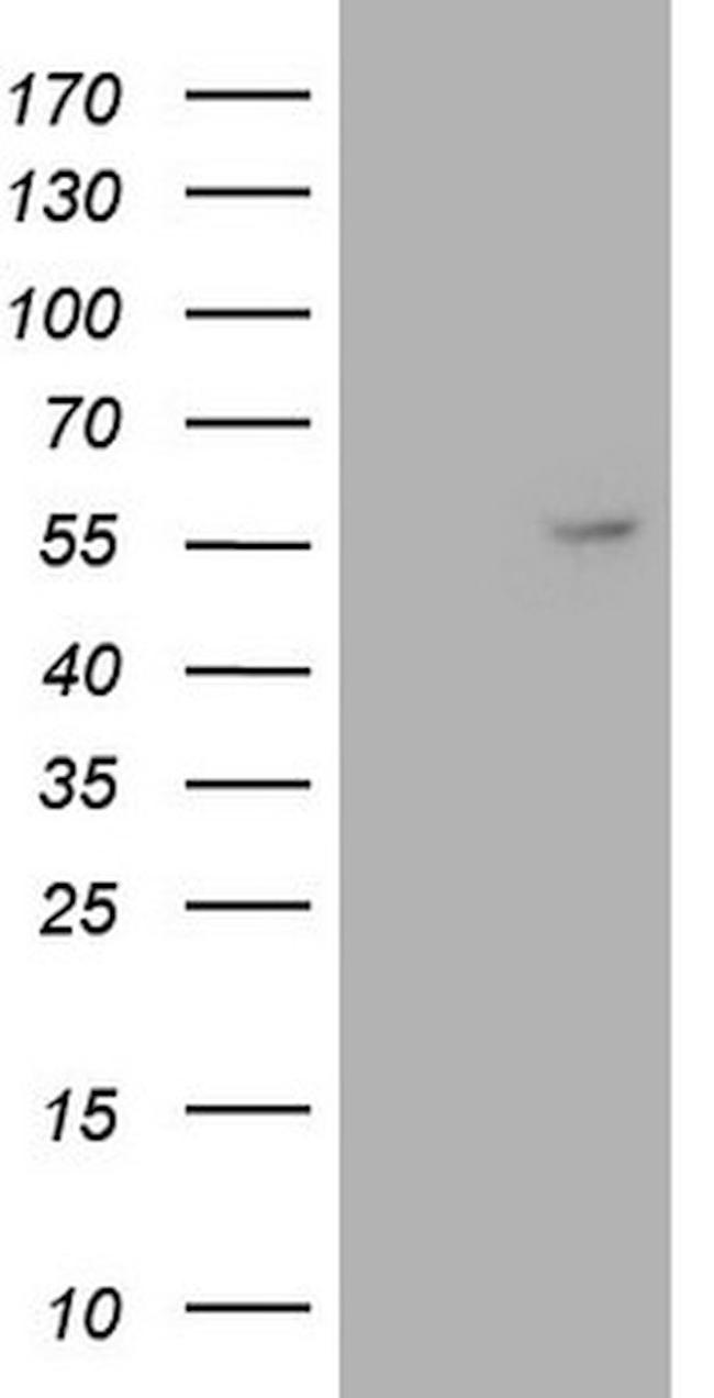 ANGPT1 Antibody in Western Blot (WB)