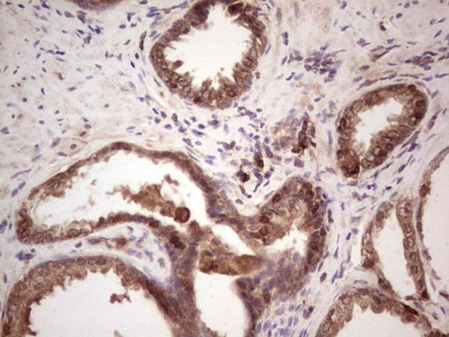 ANGPT2 Antibody in Immunohistochemistry (Paraffin) (IHC (P))