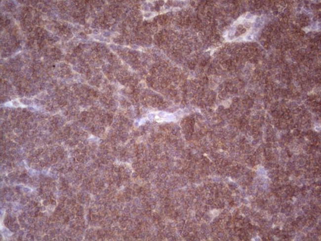 ANGPT2 Antibody in Immunohistochemistry (Paraffin) (IHC (P))