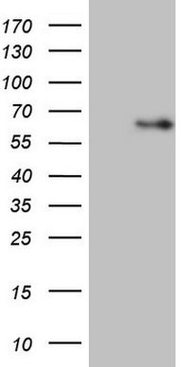 ANGPT2 Antibody in Western Blot (WB)