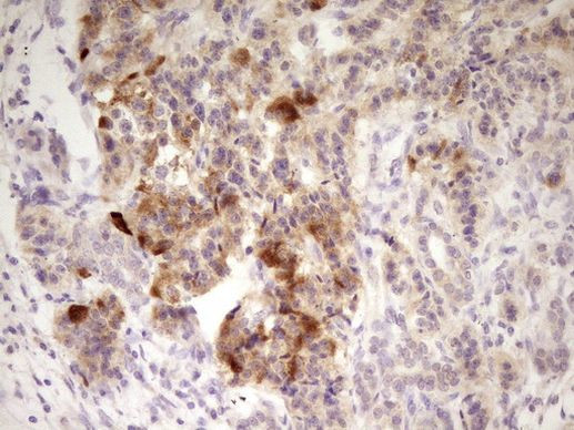 ANGPTL3 Antibody in Immunohistochemistry (Paraffin) (IHC (P))