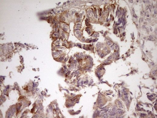 ANGPTL3 Antibody in Immunohistochemistry (Paraffin) (IHC (P))