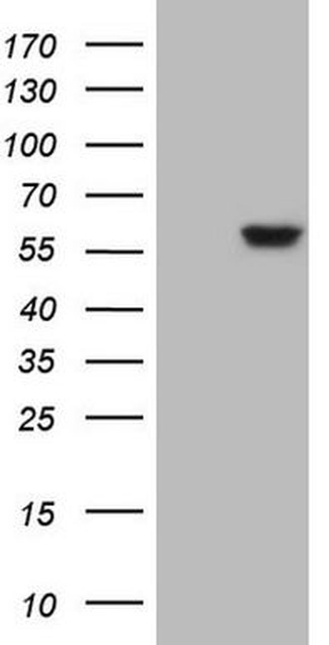 ANGPTL3 Antibody in Western Blot (WB)