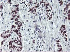 ANKRD53 Antibody in Immunohistochemistry (Paraffin) (IHC (P))