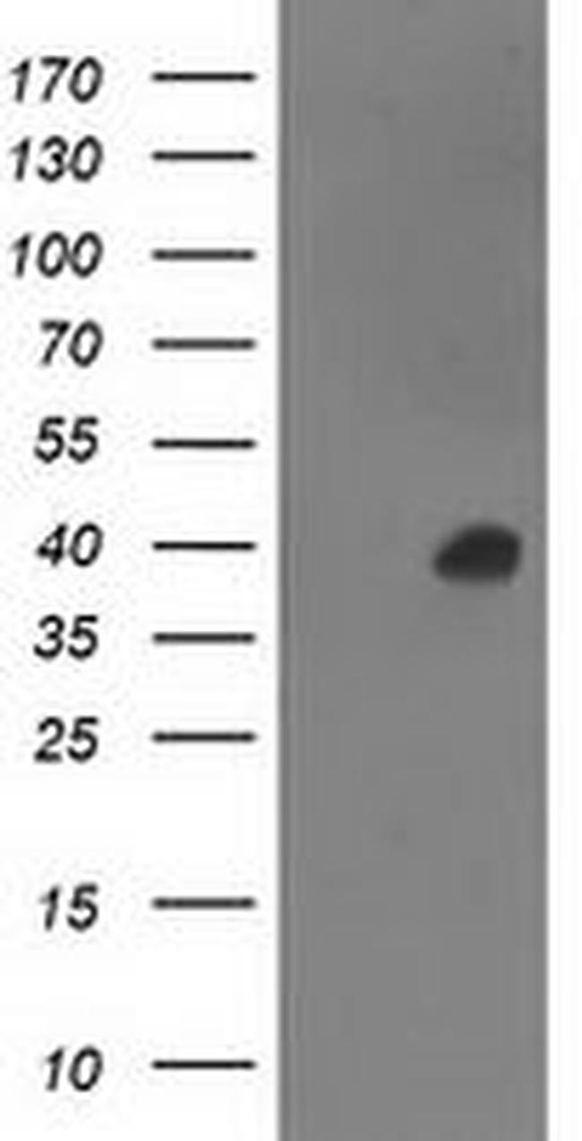 ANKRD53 Antibody in Western Blot (WB)