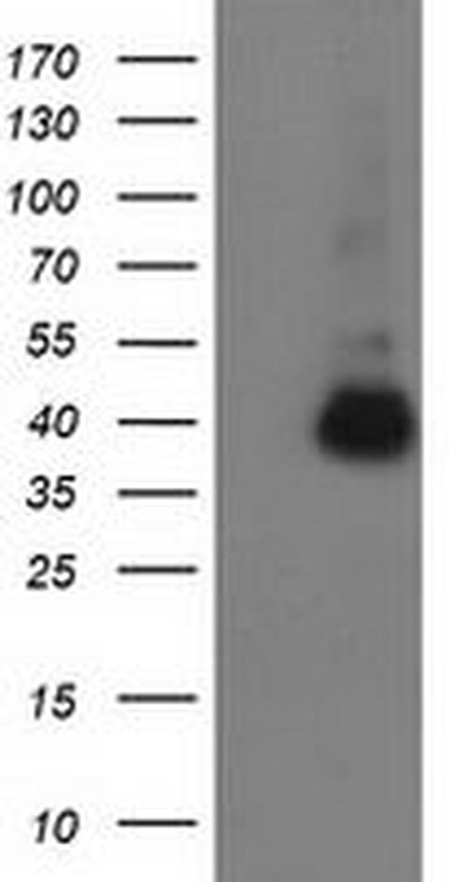 ANKRD53 Antibody in Western Blot (WB)