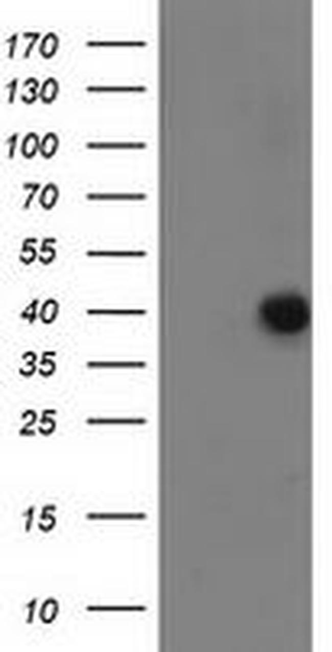 ANKRD53 Antibody in Western Blot (WB)