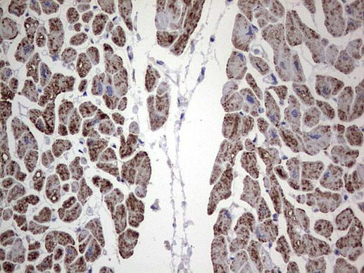 ANO1 Antibody in Immunohistochemistry (Paraffin) (IHC (P))