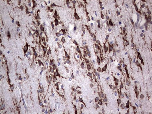 ANO1 Antibody in Immunohistochemistry (Paraffin) (IHC (P))