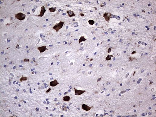 ANO1 Antibody in Immunohistochemistry (Paraffin) (IHC (P))