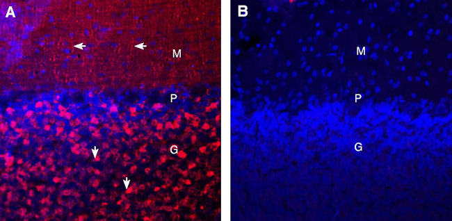 Synaptotagmin-1 (SYT1) Antibody in Immunohistochemistry (Frozen) (IHC (F))