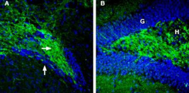 Synapsin II (SYN2) Antibody in Immunohistochemistry (Frozen) (IHC (F))