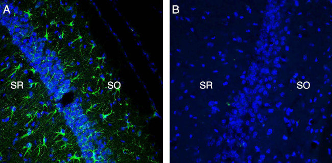 TREM2 (extracellular) Antibody in Immunohistochemistry (Frozen) (IHC (F))