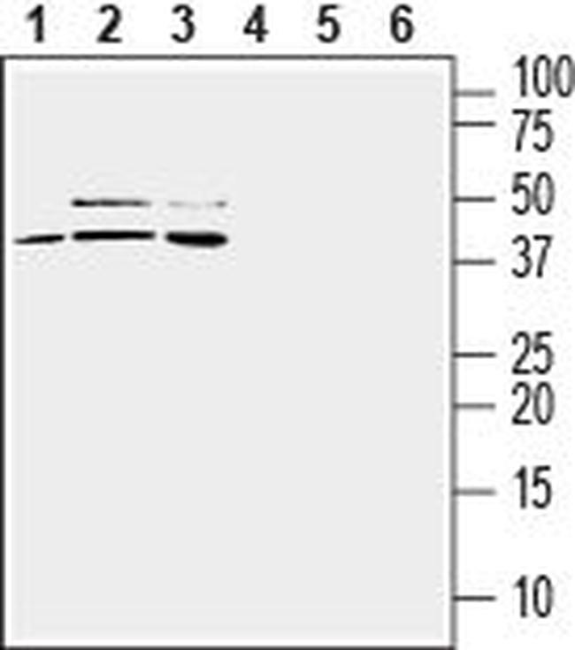 TREM2 (extracellular) Antibody in Western Blot (WB)