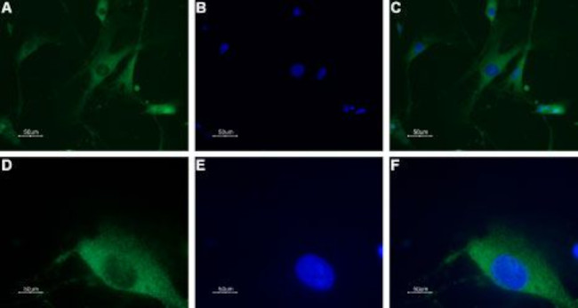 NPY1R Antibody in Immunocytochemistry (ICC/IF)