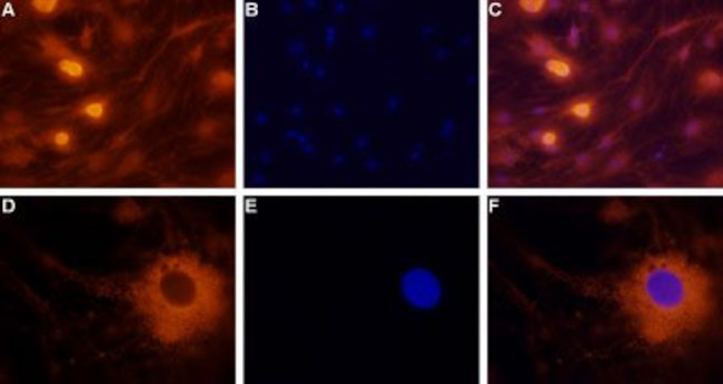 NPY2R Antibody in Immunocytochemistry (ICC/IF)