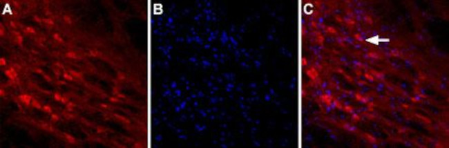 Neuroligin 2 (extracellular) Antibody in Immunohistochemistry (IHC)