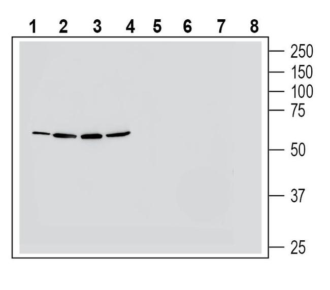 NMUR1 (extracellular) Antibody in Western Blot (WB)