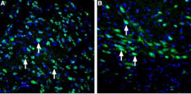 LRRK2 Antibody in Immunohistochemistry (Frozen) (IHC (F))