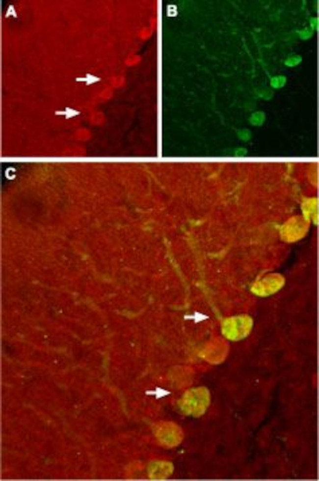 Nogo Receptor (extracellular) Antibody in Immunohistochemistry (IHC)