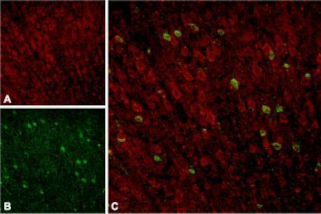 Sortilin (extracellular) Antibody in Immunohistochemistry (IHC)