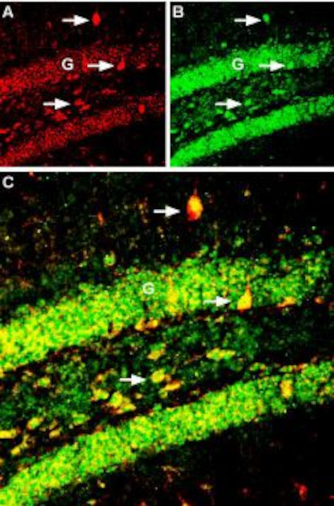 BDNF Antibody in Immunohistochemistry (Frozen) (IHC (F))