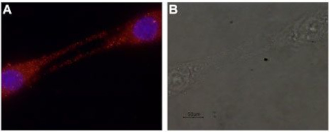 GDNF Antibody in Immunocytochemistry (ICC/IF)