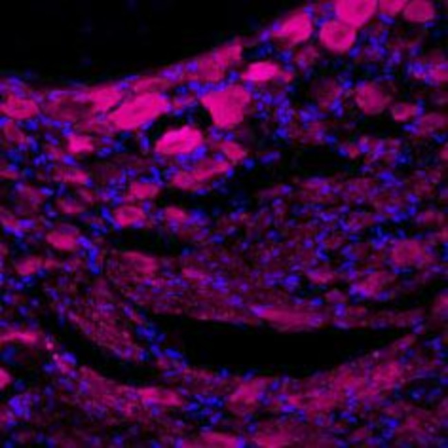 TrkA (extracellular) Antibody in Immunohistochemistry (Frozen) (IHC (F))