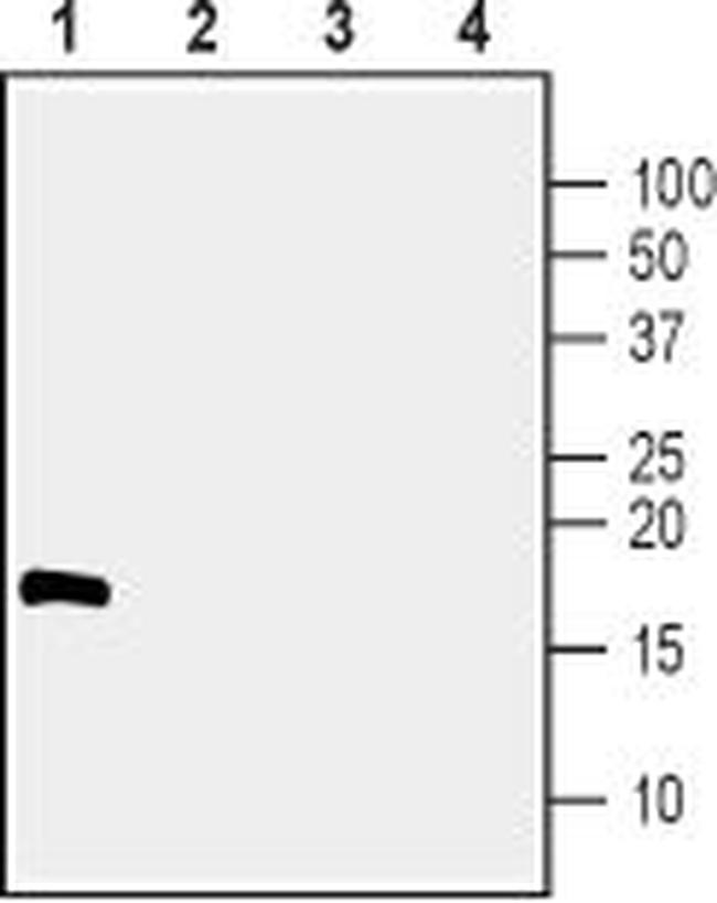 CDNF Antibody in Western Blot (WB)