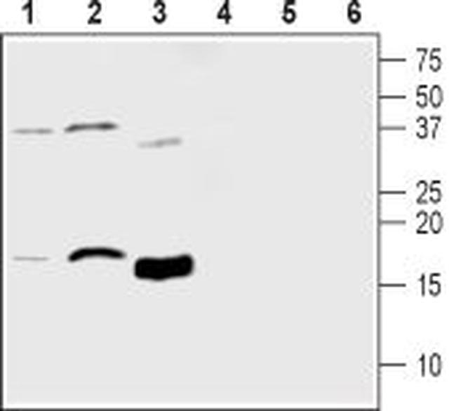 MANF/ARMET Antibody in Western Blot (WB)