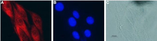 CNTF Antibody in Immunocytochemistry (ICC/IF)