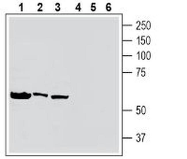 Tumor Necrosis Factor Receptor 2 (extracellular) Antibody in Western Blot (WB)