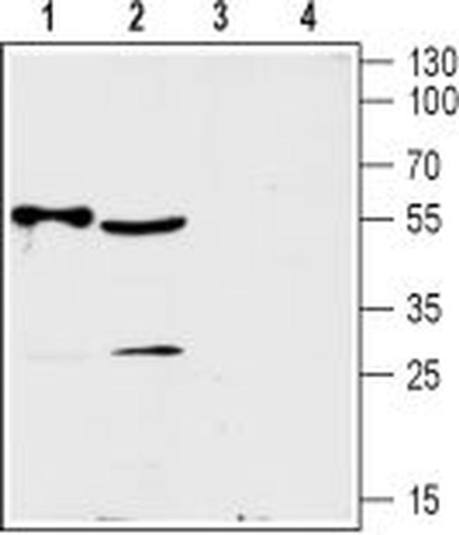 ENT2 (SLC29A2) Antibody in Western Blot (WB)