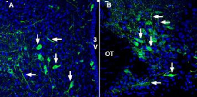 SLC17A9 Antibody in Immunohistochemistry (Frozen) (IHC (F))