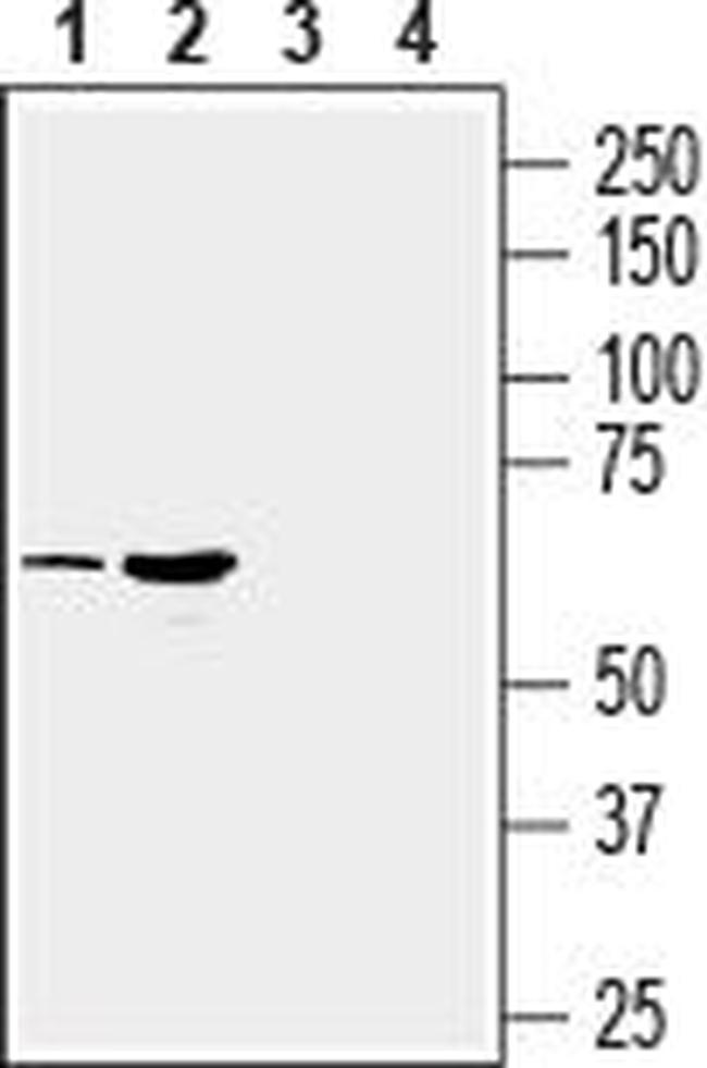 SLC17A9 Antibody in Western Blot (WB)