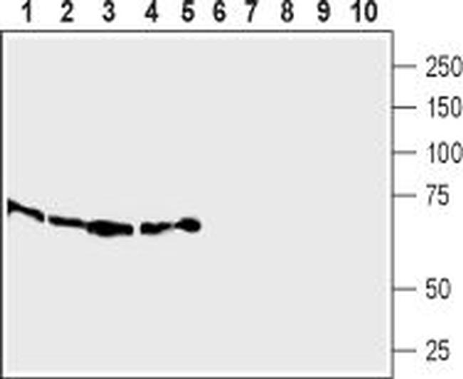 SLC7A2 (extracellular) Antibody in Western Blot (WB)