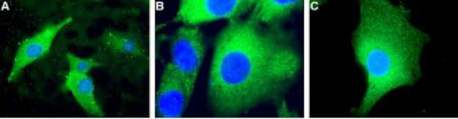 UCP2 Antibody in Immunocytochemistry (ICC/IF)