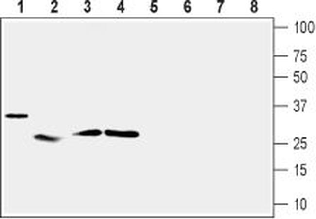 UCP2 Antibody in Western Blot (WB)