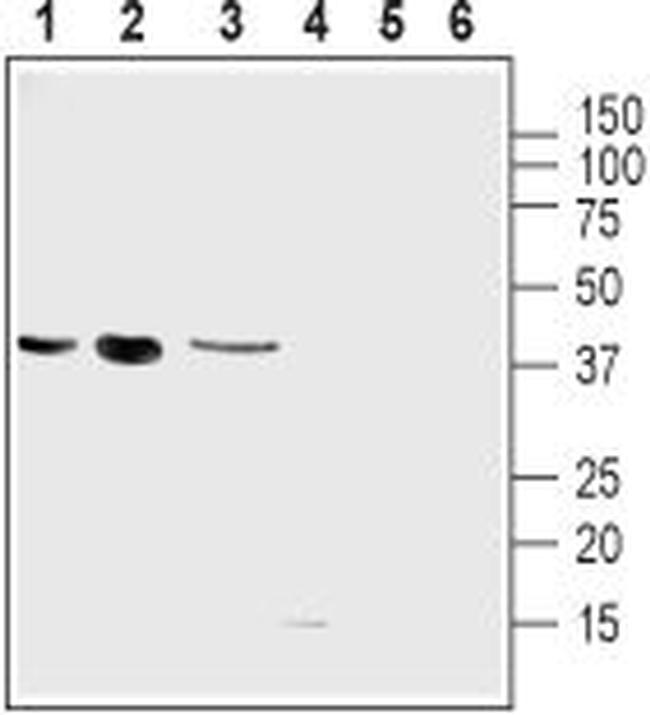 UCP2 Antibody in Western Blot (WB)