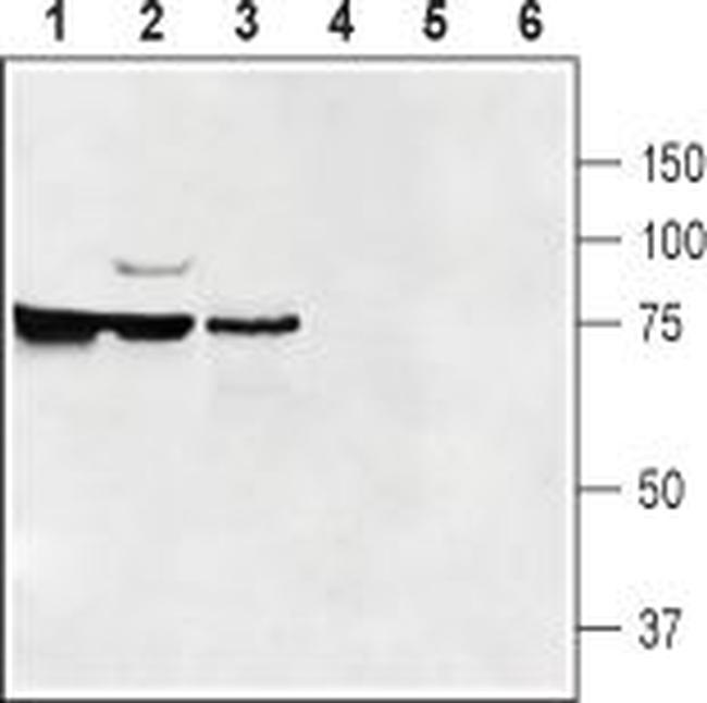 SLC47A1 Antibody in Western Blot (WB)