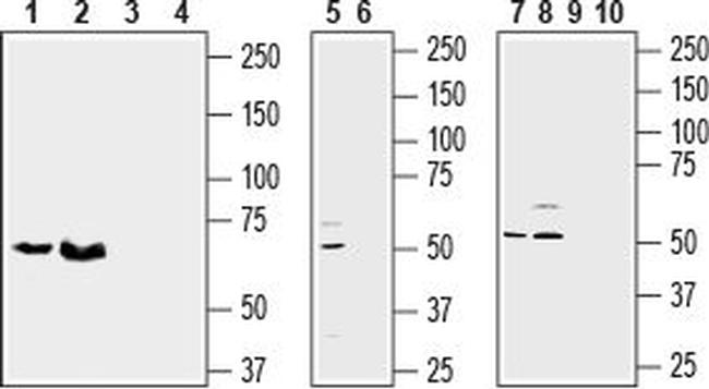 SLC38A1 Antibody in Western Blot (WB)