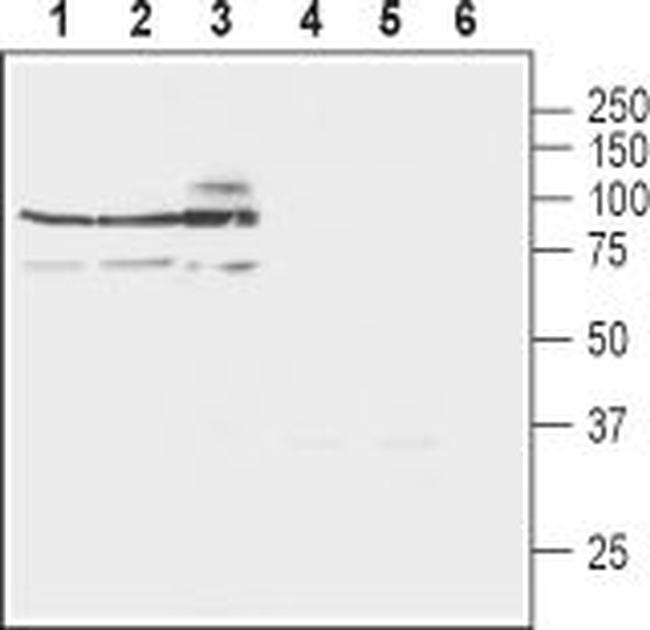 NCX3 (SLC8A3) Antibody in Western Blot (WB)