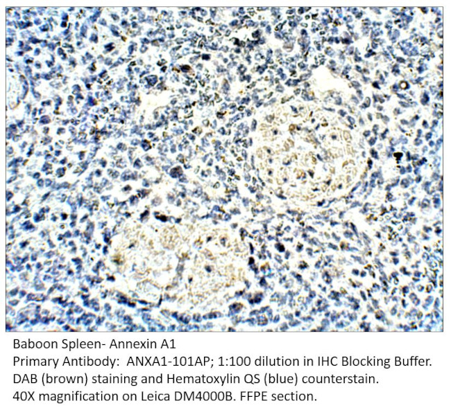 Annexin A1 Antibody in Immunohistochemistry (IHC)