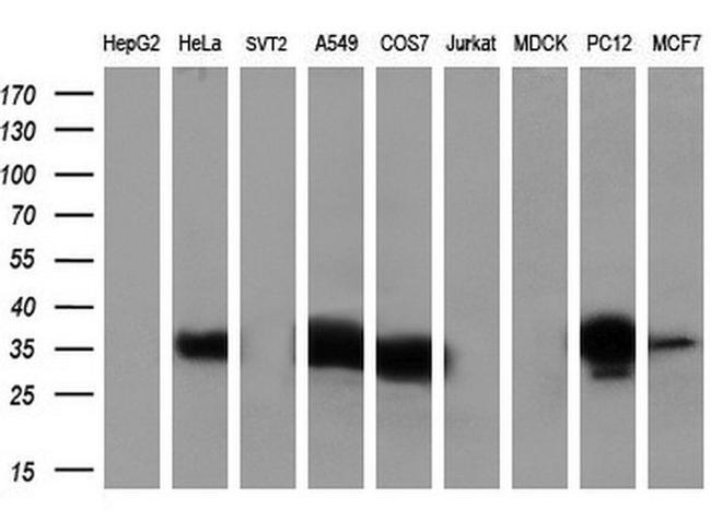 ANXA1 Antibody in Western Blot (WB)